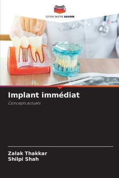 Paperback Implant immédiat [French] Book