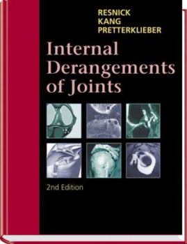 Hardcover Internal Derangements of Joints: 2-Volume Set Book
