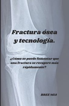 Fractura ósea y tecnología.: ¿Cómo se puede fomentar que una fractura se recupere más rápidamente? (Spanish Edition)
