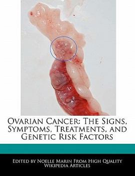Ovarian Cancer : The Signs, Symptoms, Treatments, and Genetic Risk Factors