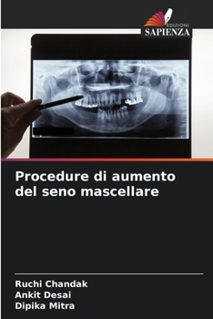 Paperback Procedure di aumento del seno mascellare [Italian] Book