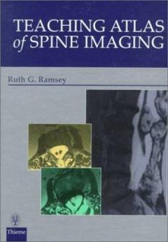 Hardcover Teaching Atlas of Spine Imaging Book
