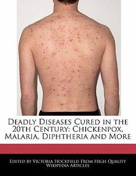 Paperback Deadly Diseases Cured in the 20th Century: Chickenpox, Malaria, Diphtheria and More Book