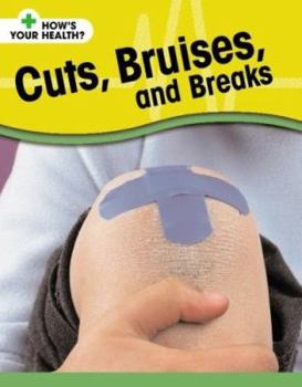 Library Binding Cuts, Bruises, and Breaks Book