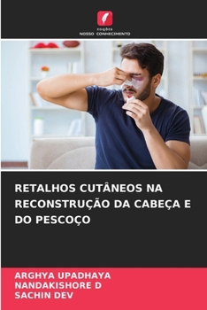 Paperback Retalhos Cutâneos Na Reconstrução Da Cabeça E Do Pescoço [Portuguese] Book