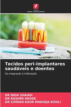 Tecidos peri-implantares saudáveis e doentes (Portuguese Edition)