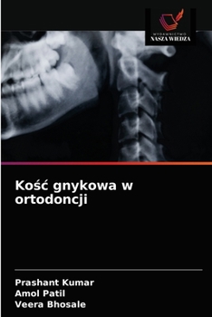 Paperback Ko&#347;c gnykowa w ortodoncji [Polish] Book