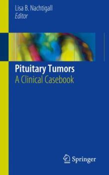Paperback Pituitary Tumors: A Clinical Casebook Book