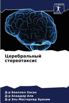 Церебральный стереотаксис