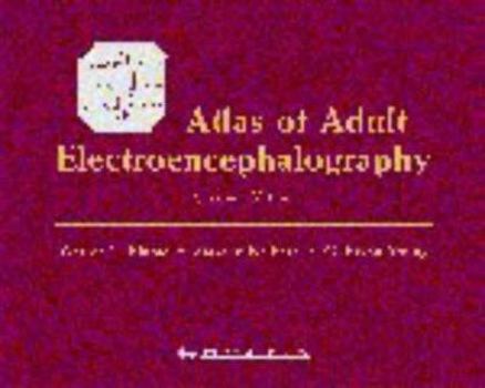 Hardcover Atlas of Adult Electroencephalography Book