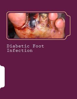 Paperback Diabetic Foot Infection Book