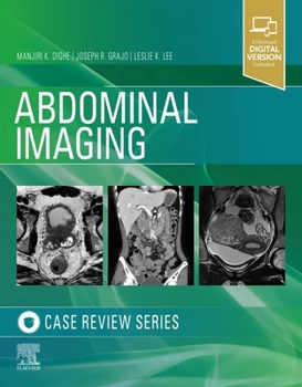 Paperback Abdominal Imaging: Case Review Series Book