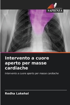Paperback Intervento a cuore aperto per masse cardiache [Italian] Book