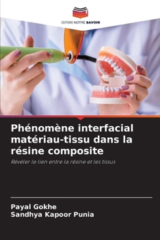 Phénomène interfacial matériau-tissu dans la résine composite