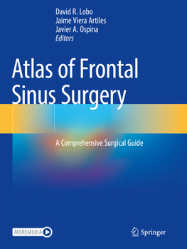 Paperback Atlas of Frontal Sinus Surgery: A Comprehensive Surgical Guide Book