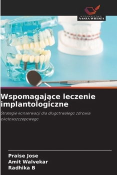 Wspomagajace leczenie implantologiczne (Polish Edition)