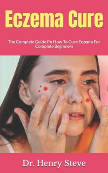 Paperback Eczema Cure: The Complete Guide Pn How To Cure Eczema For Complete Beginners Book