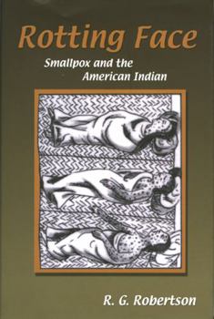 Paperback Rotting Face: Smallpox and the American Indian Book
