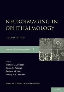 Hardcover Neuroimaging in Ophthalmology Book