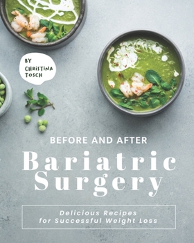 Paperback Before and After Bariatric Surgery: Delicious Recipes for Successful Weight Loss Book