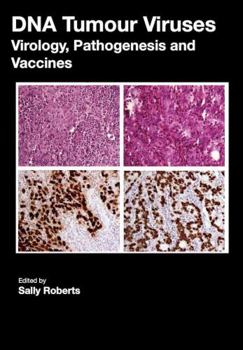 DNA Tumour Viruses: Virology, Pathogenesis and Vaccines