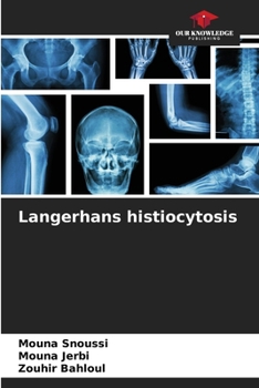 Paperback Langerhans histiocytosis Book