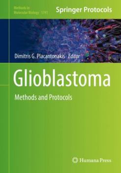 Hardcover Glioblastoma: Methods and Protocols Book