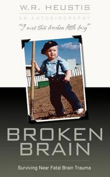 Paperback Broken Brain: Surviving Near-Fatal Brain Trauma Book