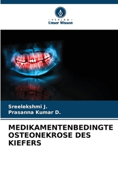 Medikamentenbedingte Osteonekrose Des Kiefers (German Edition)