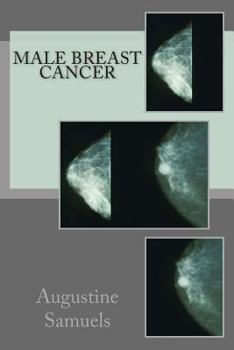 Paperback Male Breast Cancer Book