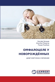 Paperback ОМФАЛОЦЕЛЕ У НОВОРОЖДЁН& [Russian] Book