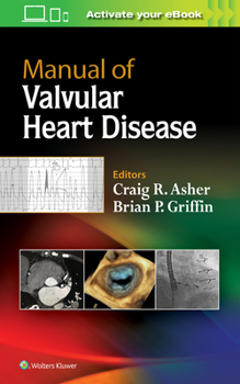 Paperback Manual of Valvular Heart Disease Book