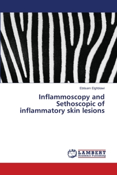 Paperback Inflammoscopy and Sethoscopic of inflammatory skin lesions Book