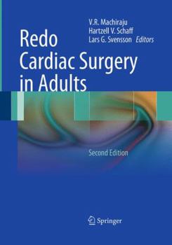 Paperback Redo Cardiac Surgery in Adults Book