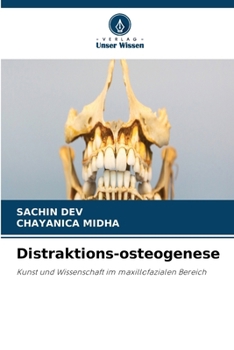 Paperback Distraktions-osteogenese [German] Book