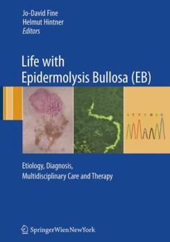 Paperback Life with Epidermolysis Bullosa (Eb): Etiology, Diagnosis, Multidisciplinary Care and Therapy Book