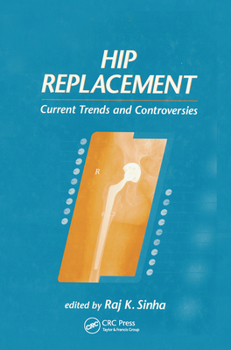 Paperback Hip Replacement: Current Trends and Controversies Book