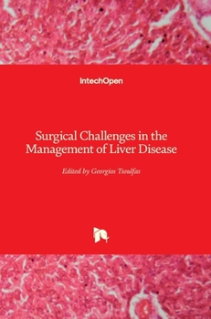 Hardcover Surgical Challenges in the Management of Liver Disease Book