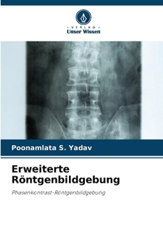 Erweiterte Röntgenbildgebung: Phasenkontrast-Röntgenbildgebung (German Edition)