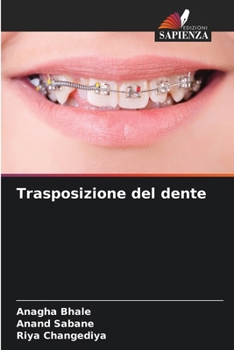 Paperback Trasposizione del dente [Italian] Book