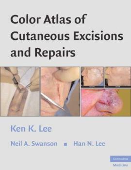 Color Atlas of Cutaneous Excisions and Repairs