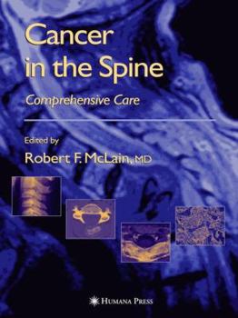 Hardcover Cancer in the Spine: Comprehensive Care Book