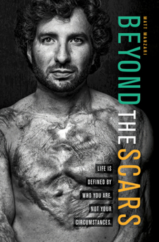 Paperback Beyond the Scars: Life Is Defined by Who You Are, Not Your Circumstances Book