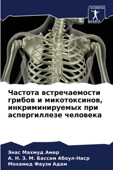 Частота встречаемости г&