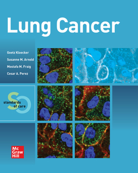 Paperback Lung Cancer: Standards of Care Book