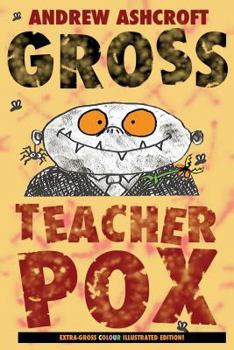 Paperback Gross Teacherpox Book