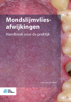 Paperback Mondslijmvliesafwijkingen: Handboek Voor de Praktijk [Dutch] Book