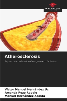 Paperback Atherosclerosis Book