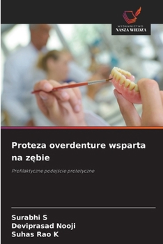 Paperback Proteza overdenture wsparta na zębie [Polish] Book