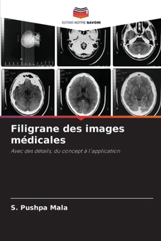 Paperback Filigrane des images médicales [French] Book